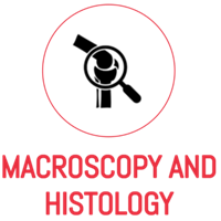 macroscopy-and-histology.png